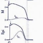 Ionic Current Basis of Electrocardiographic Waveforms A Model Study
